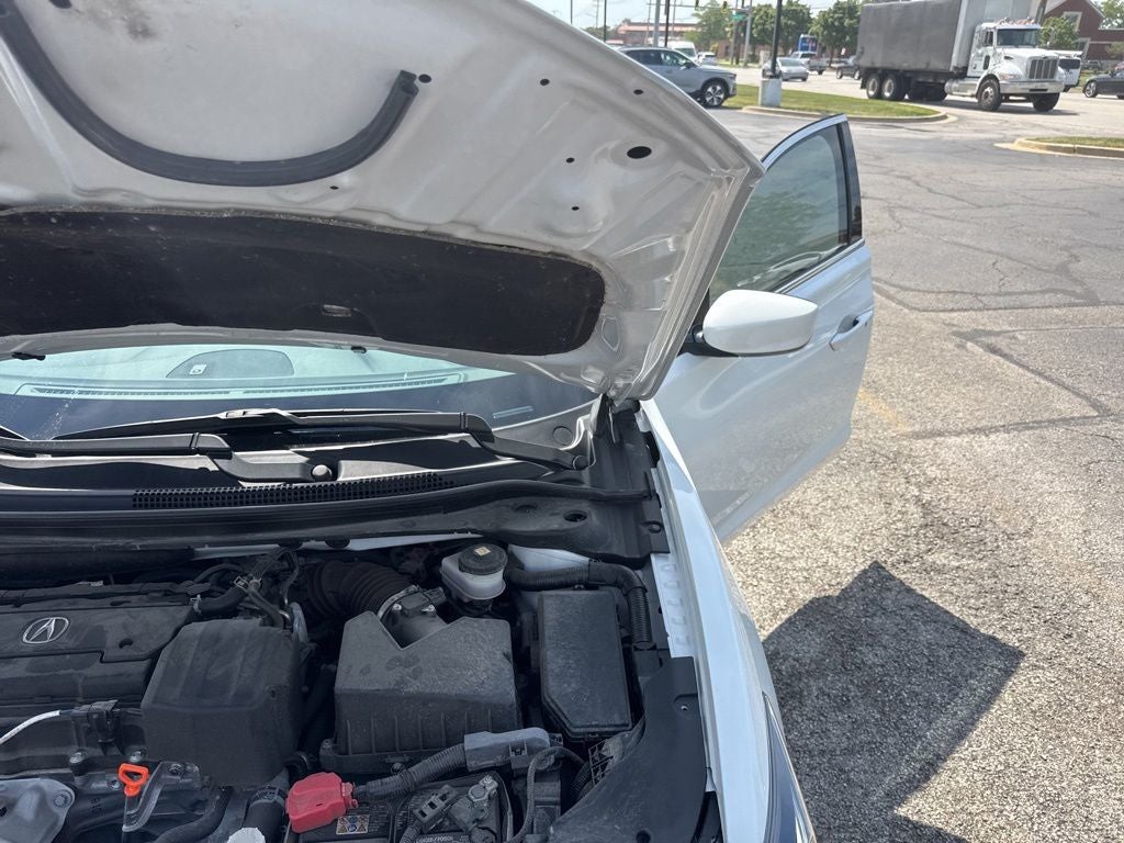 2022 Acura ILX Technology & A-SPEC Packages